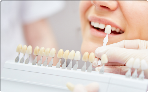 ホワイトニング