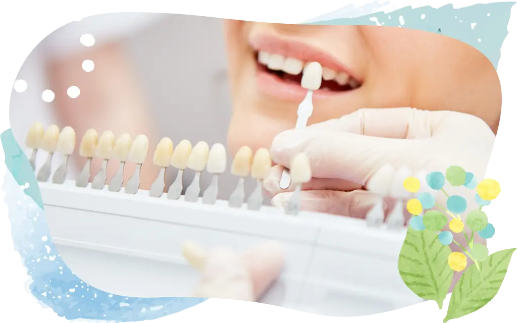 ホワイトニング