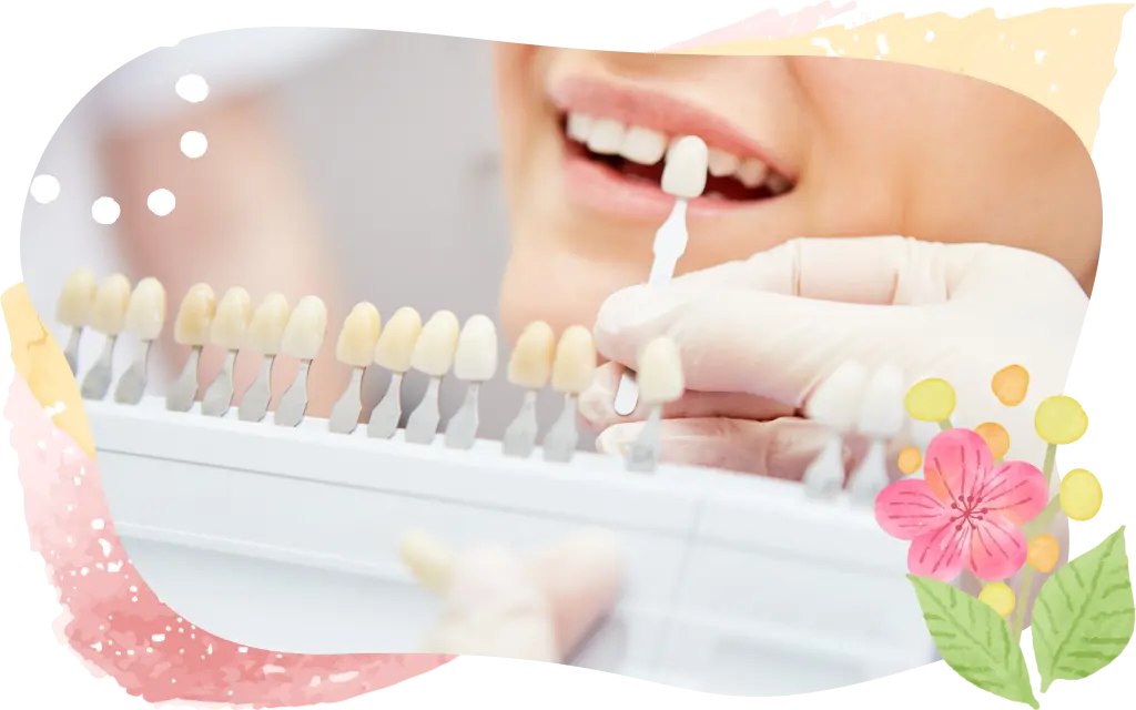 ホワイトニング